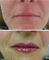 /album/fotogalerie/rty-ivet-24-3-2017-3-jpg/